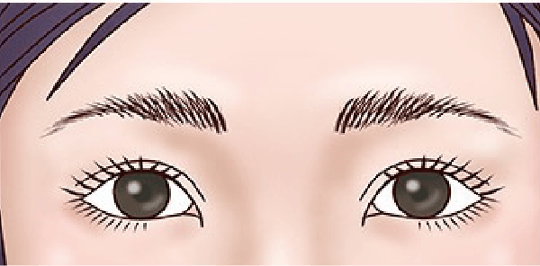 二重修正術 後の目元イラスト